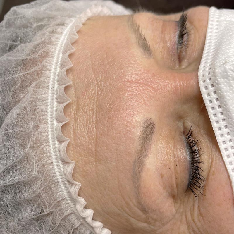 Microblading_vorher_3 Microblading_vorher_3